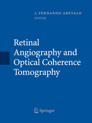 cover image of Retinal Angiography and Optical Coherence Tomography